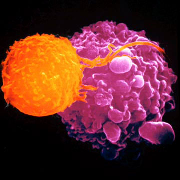 http://www.diarioabierto.es/wp-content/uploads/2012/06/linfocito-T-matando-celula-cancer.jpg?height=auto&width=auto&modal=true