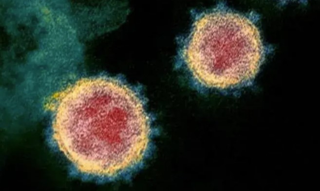 Micrografía de viriones de SARS-CoV-2.