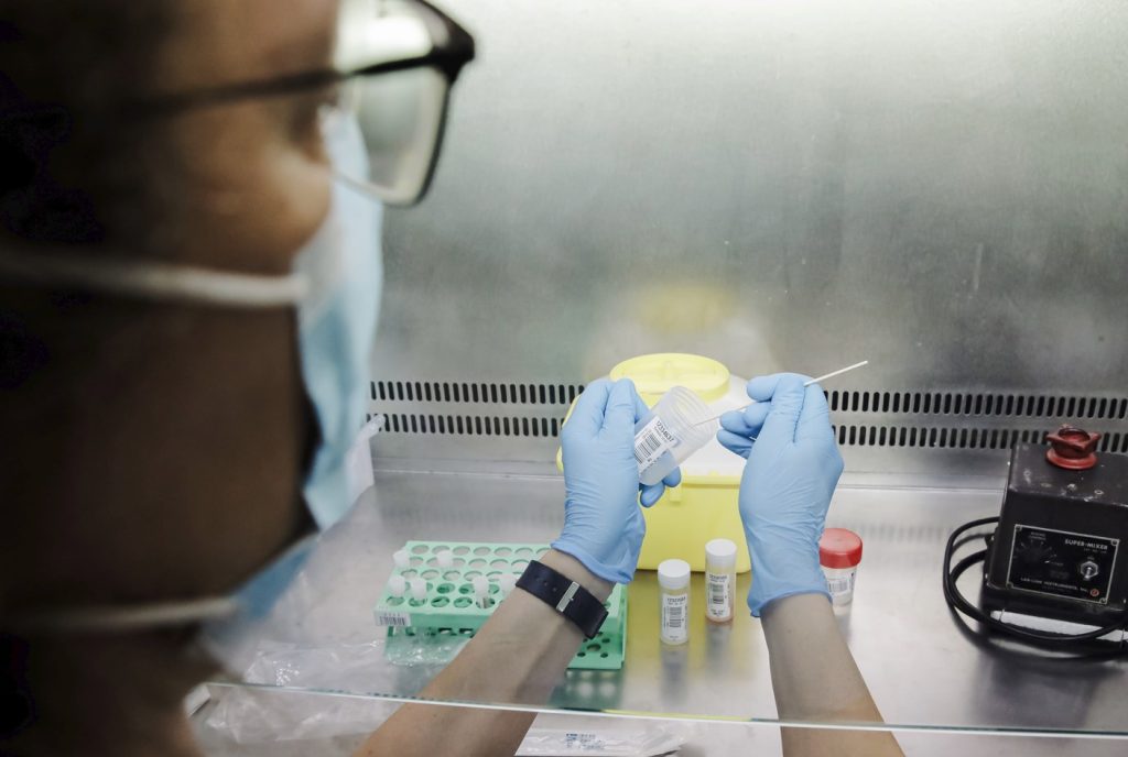 Una técnico de laboratorio sostiene una de las pruebas de análisis para la viruela del mono.  Carlos Luján / Europa Press