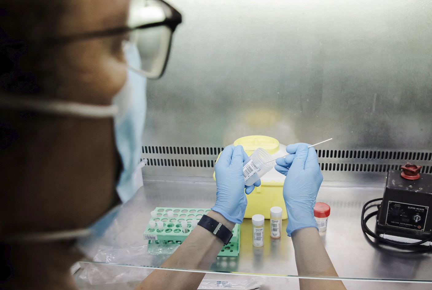 Una técnico de laboratorio sostiene una de las pruebas de análisis para la viruela del mono. Carlos Luján / Europa Press